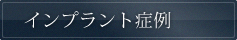 インプラント症例